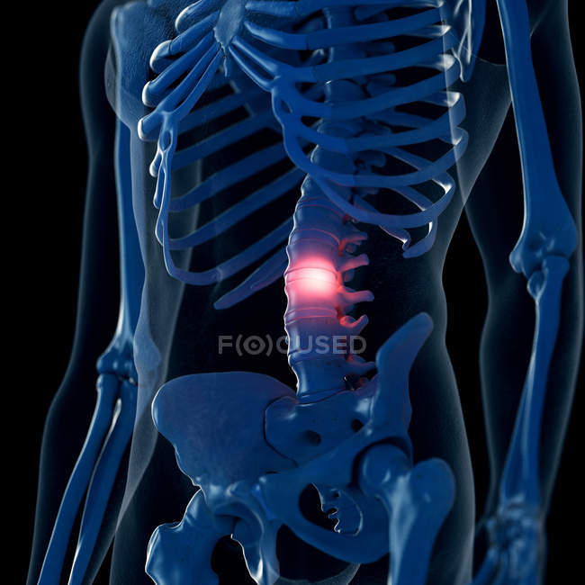 Illustration numérique de la colonne lombaire douloureuse dans le squelette humain . — Photo de stock