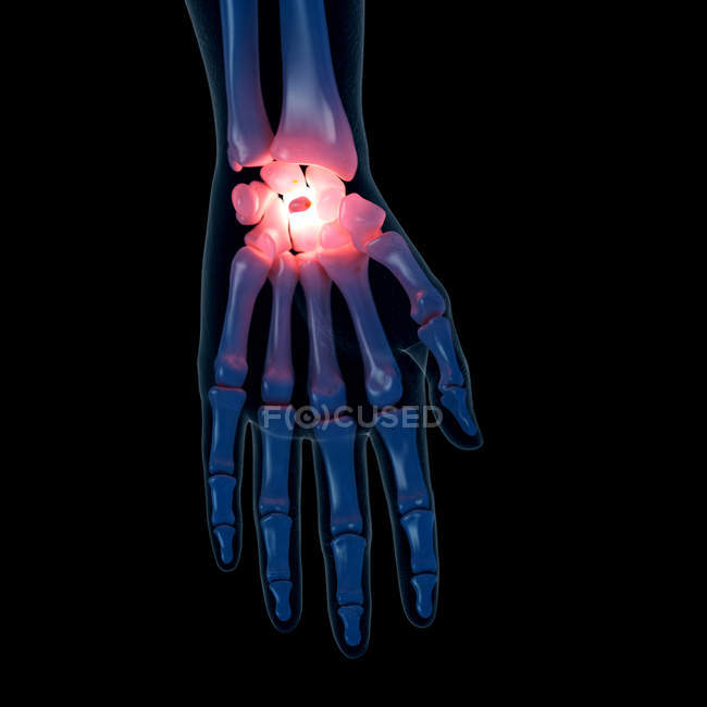 Illustration numérique du poignet douloureux dans le squelette humain . — Photo de stock