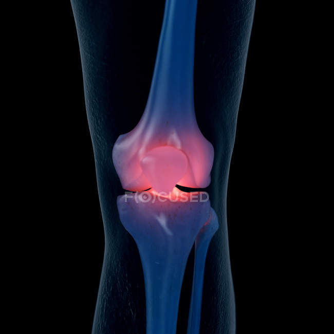 Цифрова ілюстрація болючого коліна в людському скелеті . — стокове фото