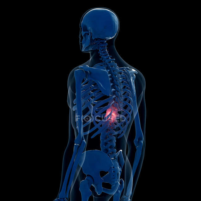 Digitale Darstellung des schmerzhaften Rückens im menschlichen Skelett. — Stockfoto
