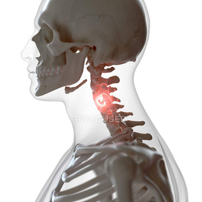 Ilustración digital de la columna cervical dolorosa en el esqueleto humano . - foto de stock