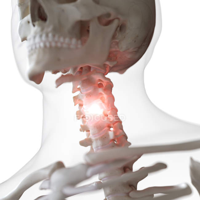 Ilustración digital de la columna cervical dolorosa en el esqueleto humano
. - foto de stock