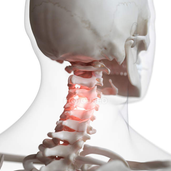 Ilustración digital de la columna cervical dolorosa en el esqueleto humano . - foto de stock