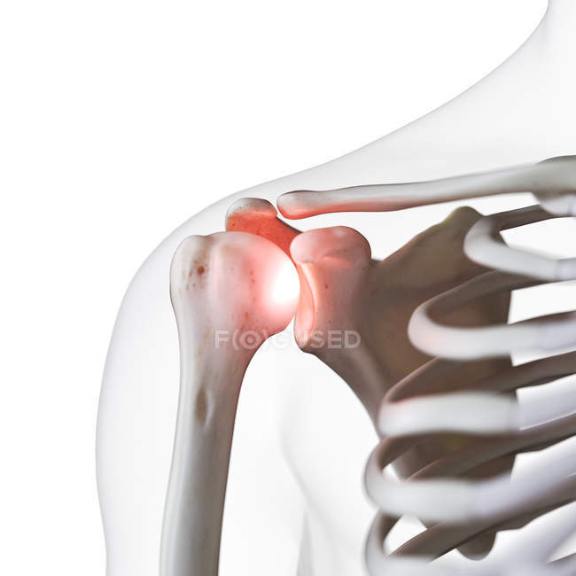 Digital illustration of painful shoulder joint in human skeleton. — Stock Photo