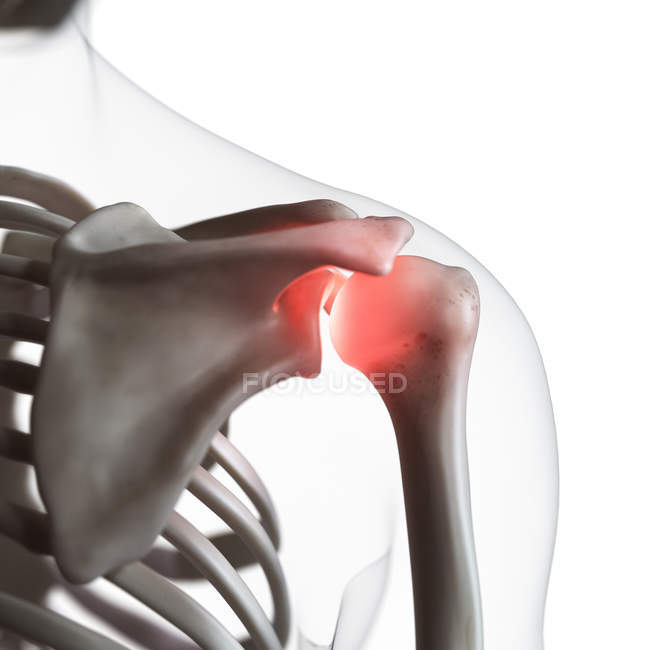 Цифровий ілюстрація хворобливі плечовий суглоб в скелет людини. — стокове фото