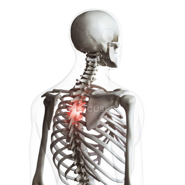Illustration numérique du dos douloureux dans le squelette humain . — Photo de stock