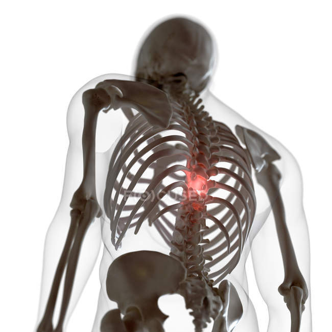 Illustrazione digitale della schiena dolorosa nello scheletro umano . — Foto stock