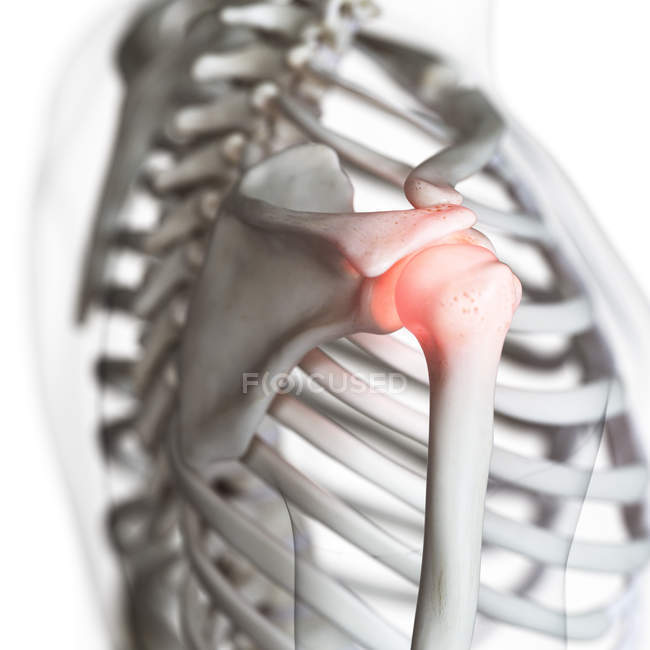 Ilustración digital de la articulación dolorosa del hombro en el esqueleto humano . - foto de stock