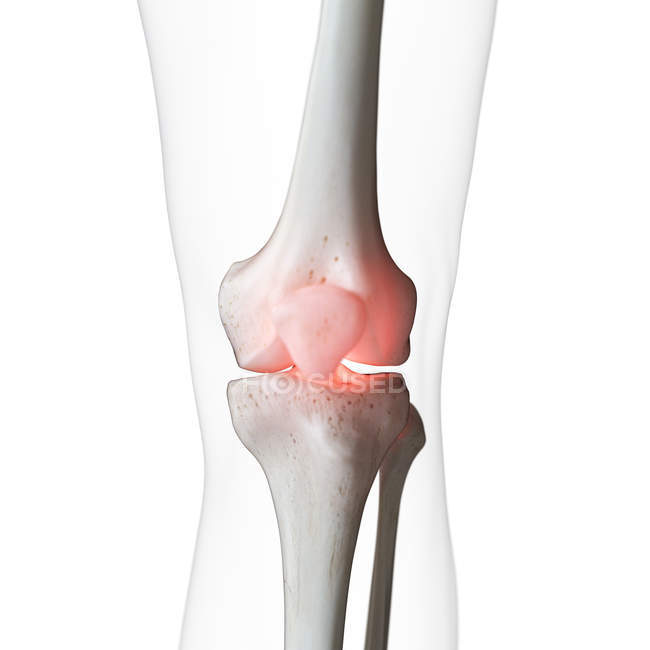 Digital illustration of painful knee in human skeleton. — Stock Photo