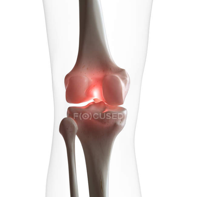 Ilustración digital de rodilla dolorosa en esqueleto humano . - foto de stock