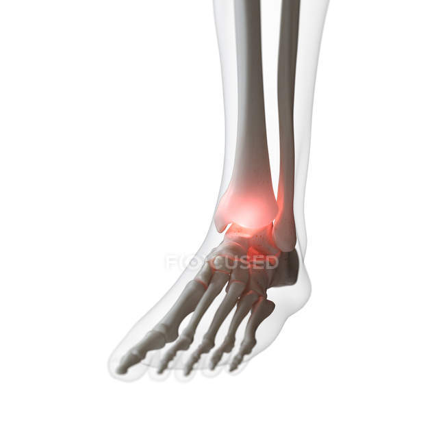 Digital illustration of painful ankle in human skeleton. — Stock Photo