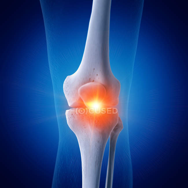 Illustration numérique du genou douloureux dans le squelette humain . — Photo de stock
