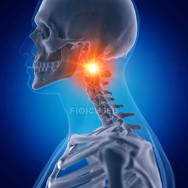 Digital illustration of painful atlas bone in human skeleton. — Stock Photo