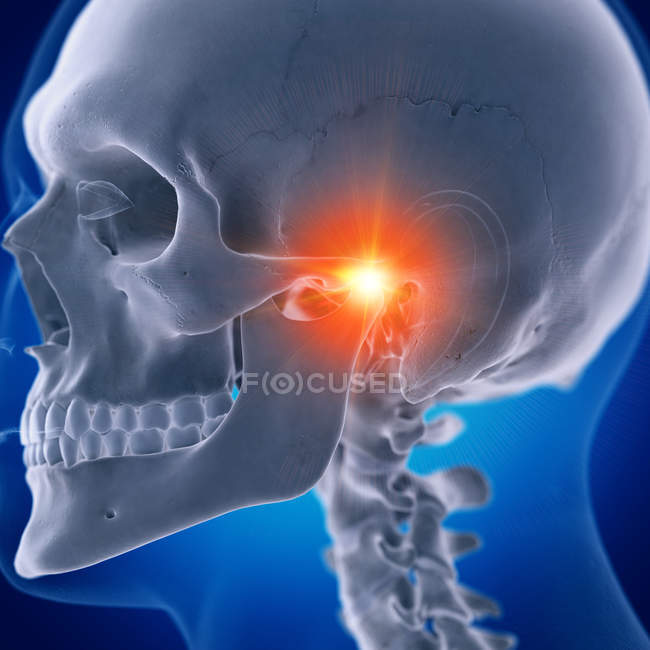 Digital illustration of painful temporomandibular joint in human skeleton. — Stock Photo
