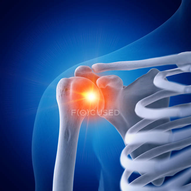 Illustration of painful shoulder in human skeleton on blue background. — Stock Photo