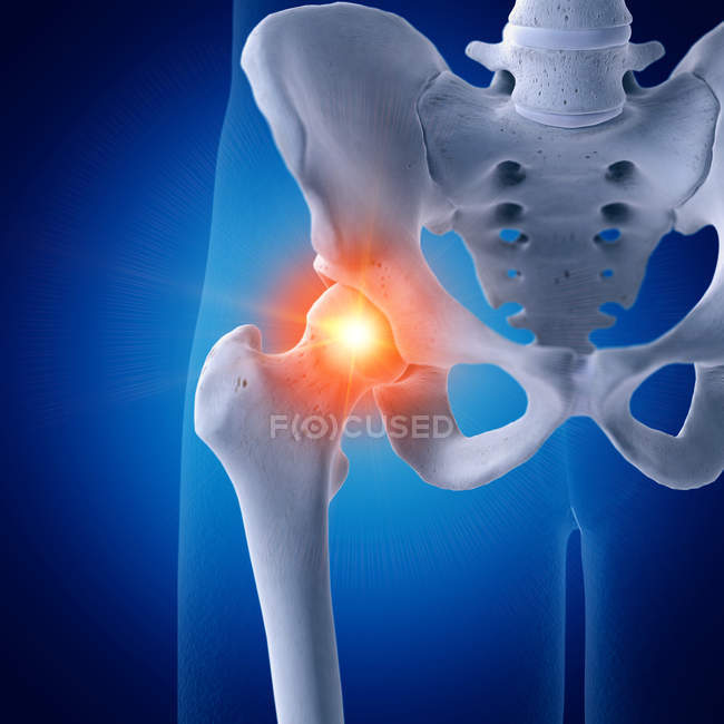 Ilustración de la articulación dolorosa de la cadera en el esqueleto humano sobre fondo azul . - foto de stock