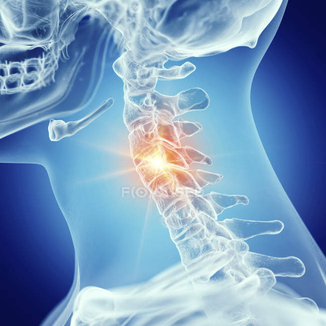 Ilustração da coluna cervical no esqueleto humano sobre fundo azul . — Fotografia de Stock