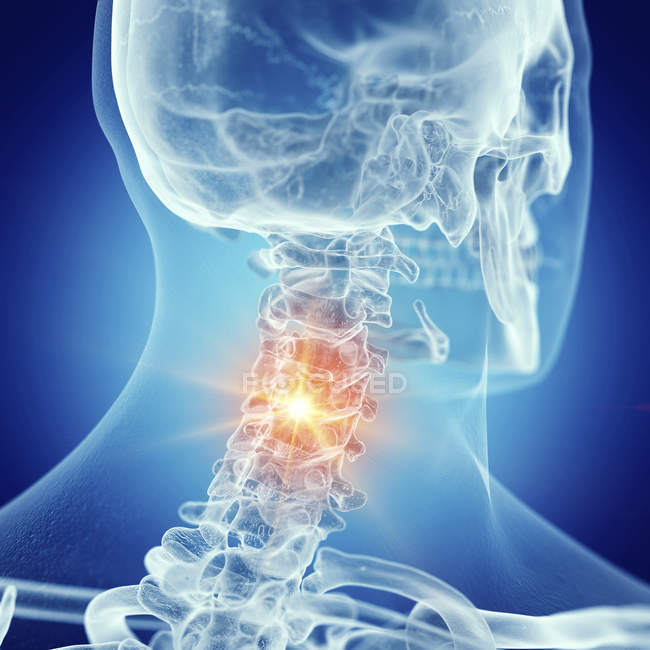 Illustrazione della colonna vertebrale cervicale dolorosa nello scheletro umano su sfondo blu . — Foto stock