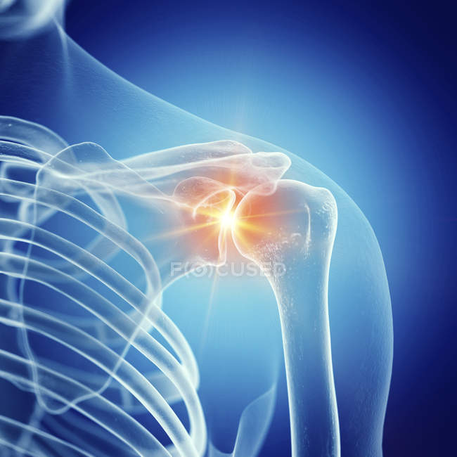 Illustration of painful shoulder joint in human skeleton. — Stock Photo