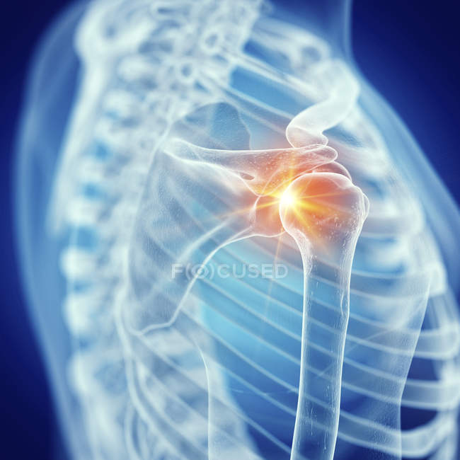 Ilustración de la articulación dolorosa del hombro en el esqueleto humano . - foto de stock