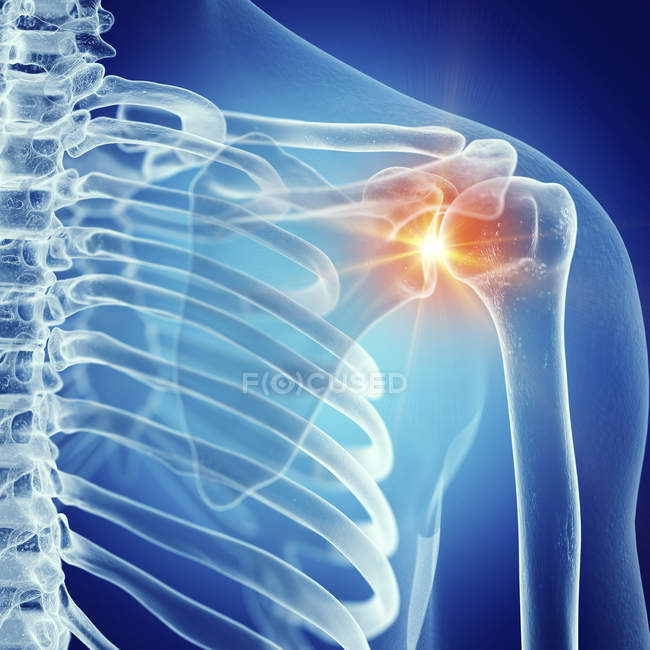Ilustración de la articulación dolorosa del hombro en el esqueleto humano sobre fondo azul
. - foto de stock