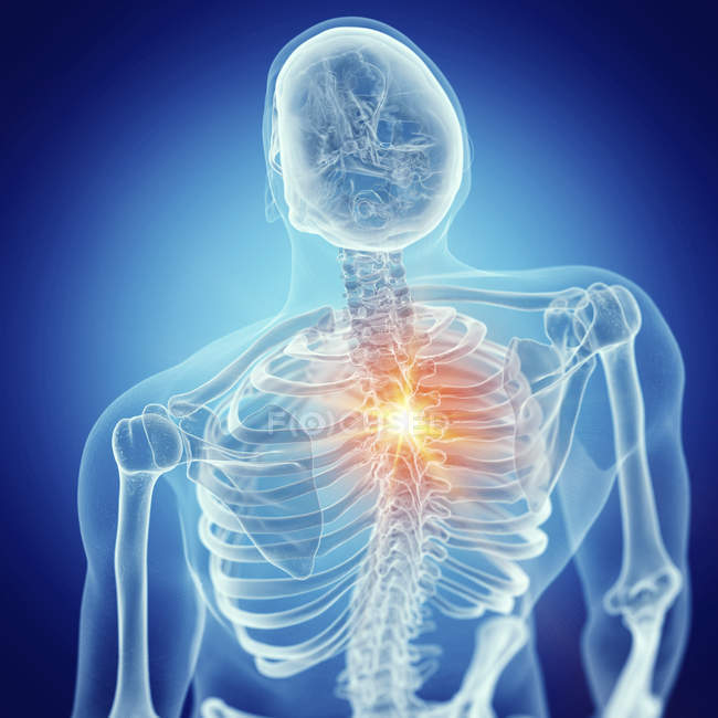 Ilustração da dor nas costas no esqueleto humano em fundo azul . — Fotografia de Stock