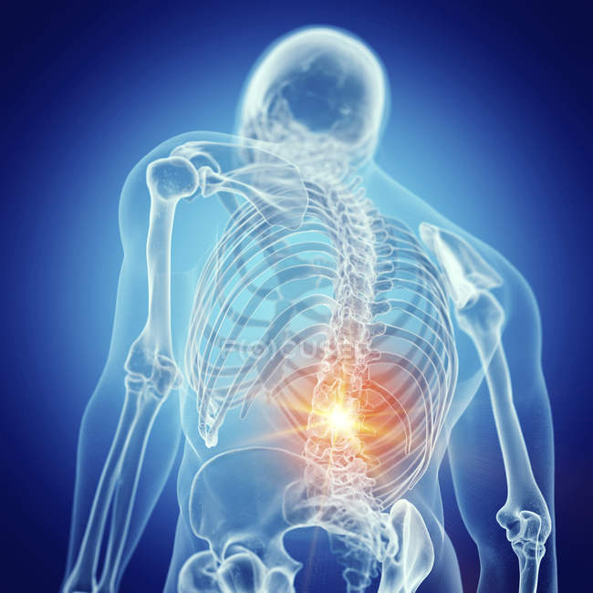 Illustration du bas du dos douloureux dans le squelette humain . — Photo de stock