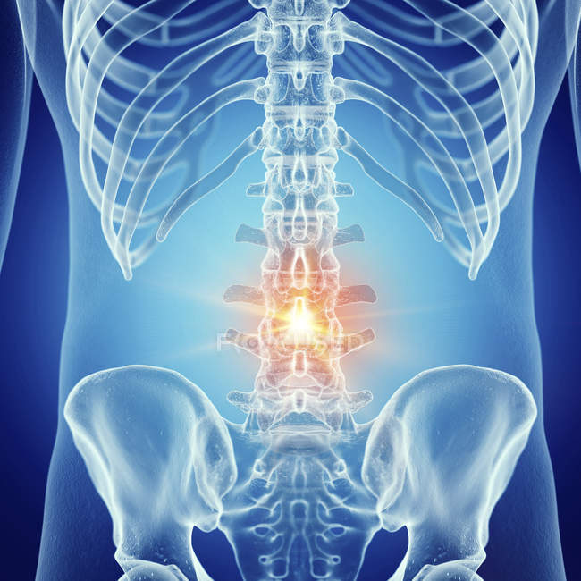 Illustration der schmerzhaften Lendenwirbelsäule im menschlichen Skelett. — Stockfoto