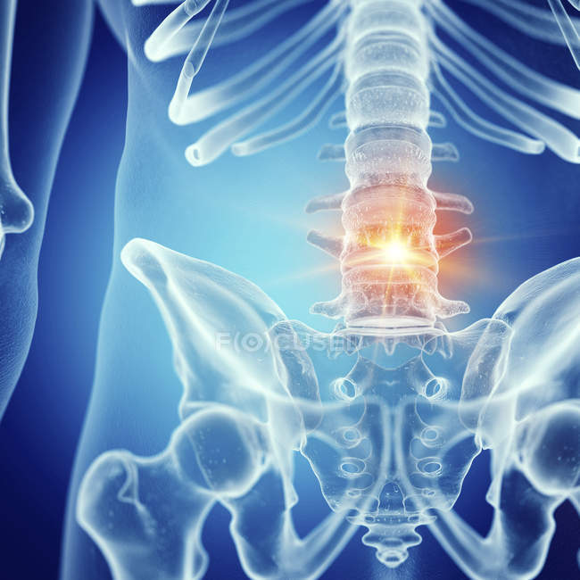 Ilustración del dolor lumbar en el esqueleto humano sobre fondo azul
. — Stock Photo