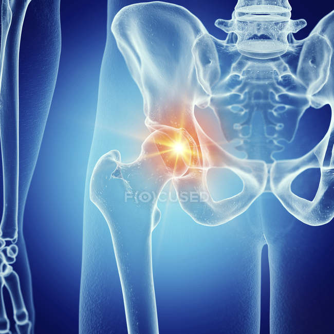 Illustration d'une articulation douloureuse de la hanche dans le squelette humain
. — Photo de stock
