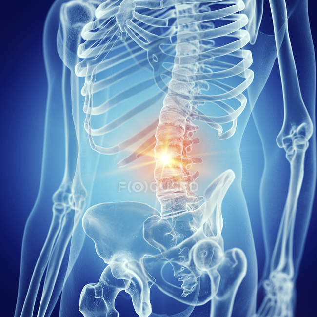 Illustration du bas du dos douloureux dans le squelette humain . — Photo de stock