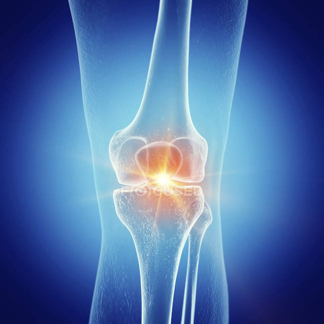 Illustration du genou douloureux dans le squelette humain . — Photo de stock