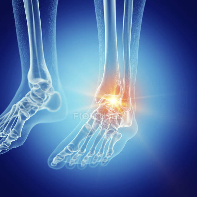 Ilustração do tornozelo doloroso no esqueleto humano . — Fotografia de Stock