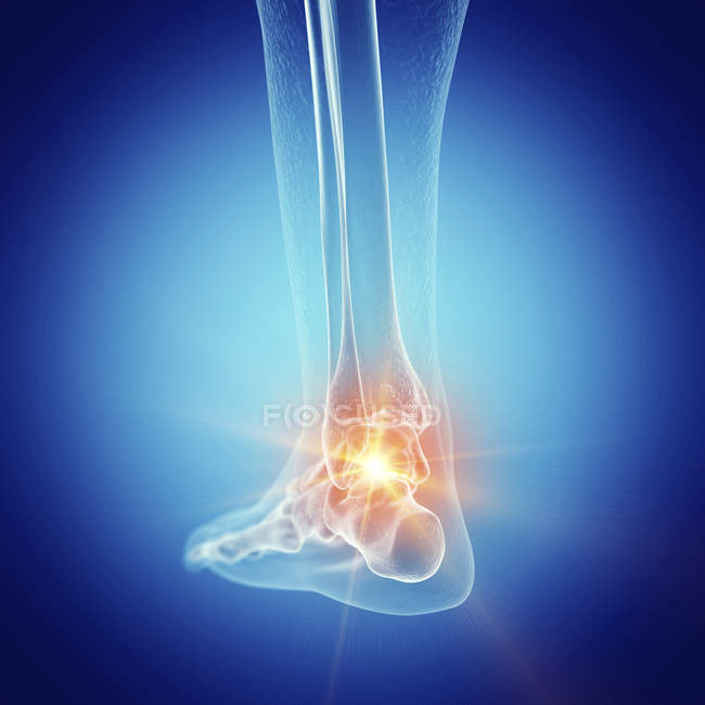 Illustration of painful ankle in human skeleton. — Stock Photo