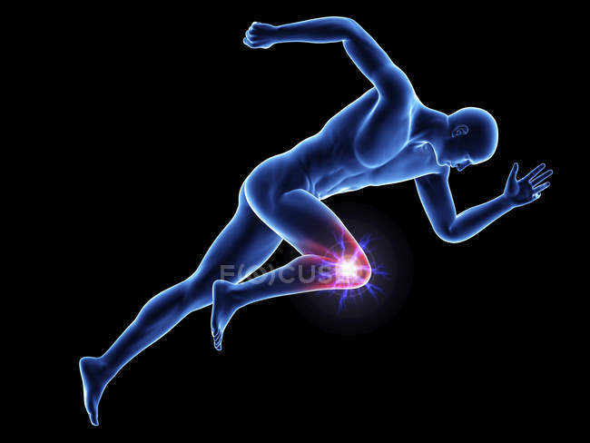 Ilustración de la silueta del velocista masculino que muestra la articulación dolorosa sobre fondo negro . - foto de stock