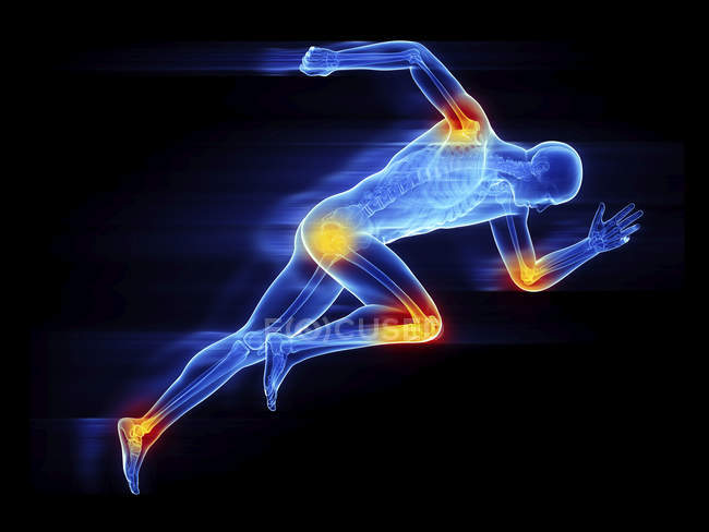 Illustration of male sprinter silhouette showing painful joints on black background. — Stock Photo