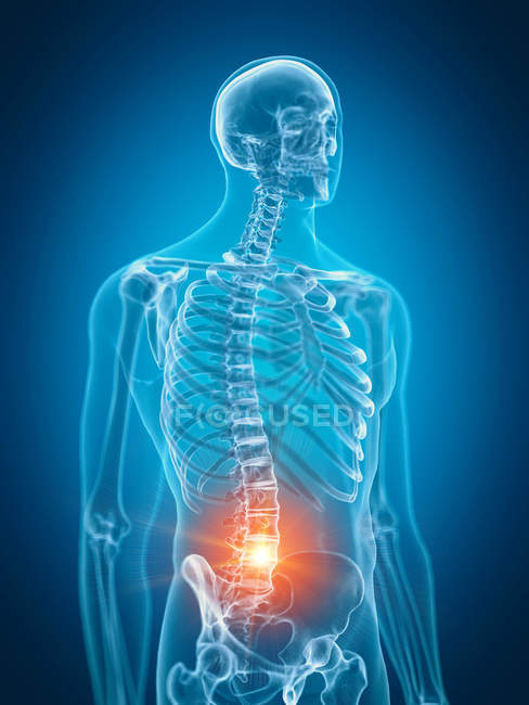 Illustration der schmerzhaften unteren Wirbelsäule im menschlichen Skelettteil. — Stockfoto
