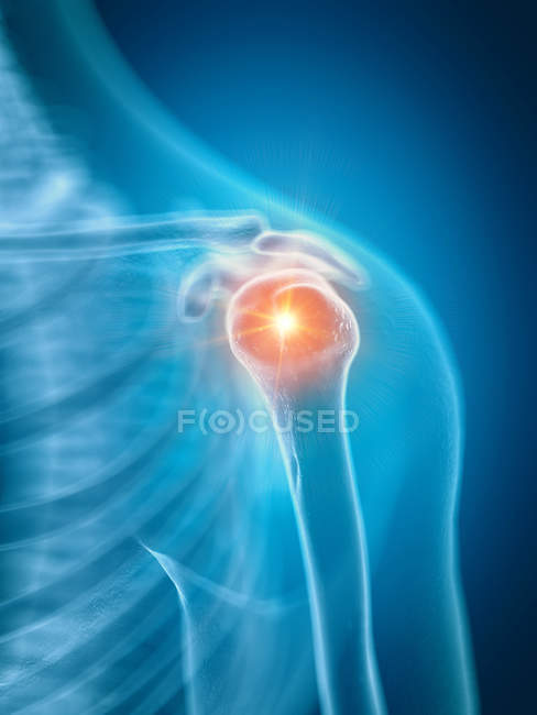 Illustration of painful shoulder in human skeleton part. — Stock Photo