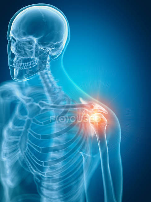Illustration of painful shoulder in human skeleton part. — Stock Photo