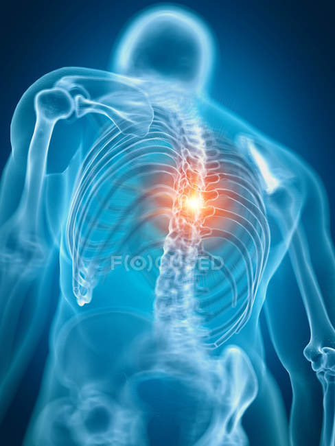 Ilustración de dolor de espalda en parte esqueleto humano . - foto de stock
