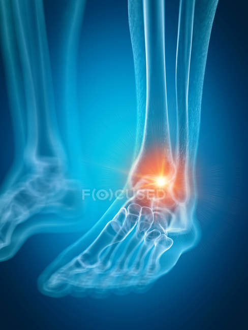 Ilustración del tobillo doloroso en la parte del esqueleto humano . - foto de stock