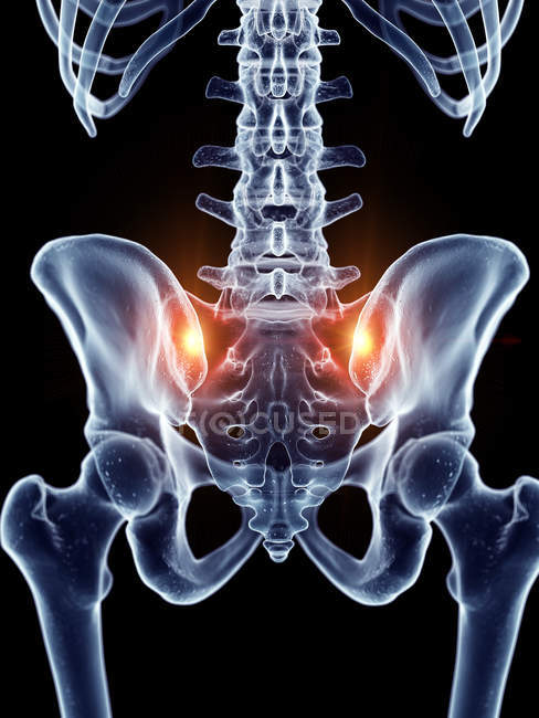 Illustration of painful sacrum joints in human skeleton part. — Stock Photo