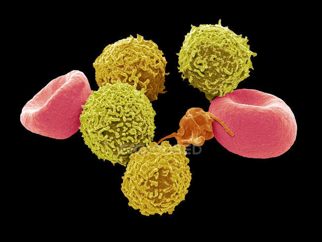 Micrógrafo electrónico de barrido coloreado de eritrocitos de glóbulos rojos humanos, leucocitos de glóbulos blancos y trombocitos plaquetarios
. - foto de stock
