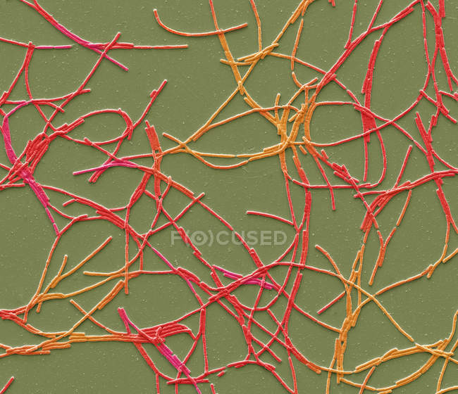Цветной сканирующий электронный микрограф грамположительной сибирской язвы, палочковидные бактерии, известные как Bacillus anthracis . — стоковое фото