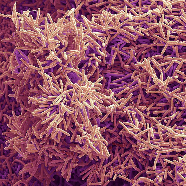 Формування нальоту бактерій, кольорові сканування електронна мікрофотографія. — стокове фото
