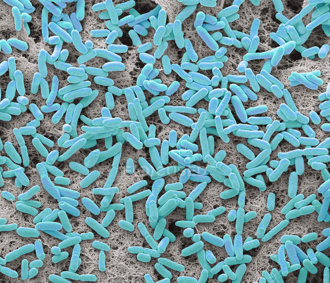 Micrógrafo electrónico de barrido coloreado de bacterias gramnegativas en forma de barra Escherichia coli del intestino humano
. - foto de stock