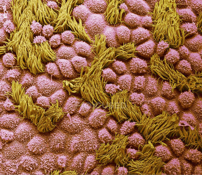 Кольорові сканування електрон мікрофотографія поверхні людського Фаллопієва труб з епітелію стовпчастих клітин з вії. — стокове фото