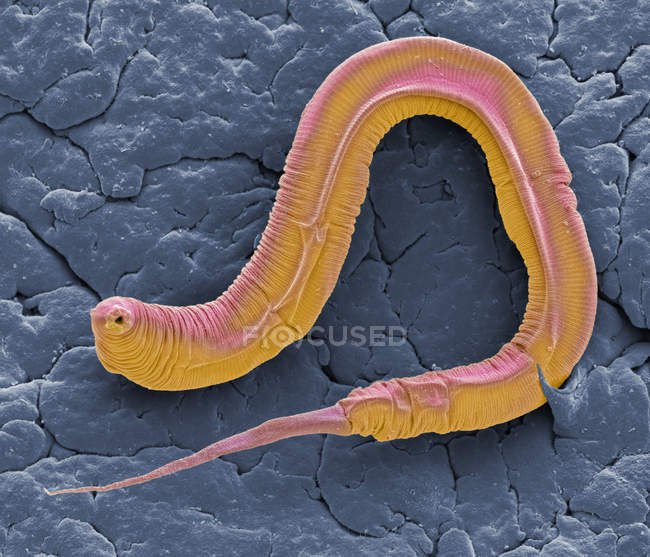 Caenorhabditis elegans паразита хробака, кольорові сканування електронна мікрофотографія. — стокове фото
