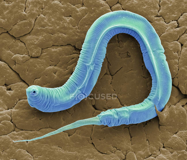 Caenorhabditis elegans gusano parásito, micrografía electrónica de barrido de color . - foto de stock