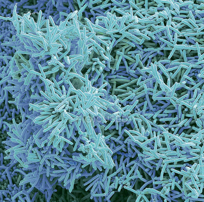 Bactéries formant des plaques, micrographie électronique à balayage coloré
. — Photo de stock